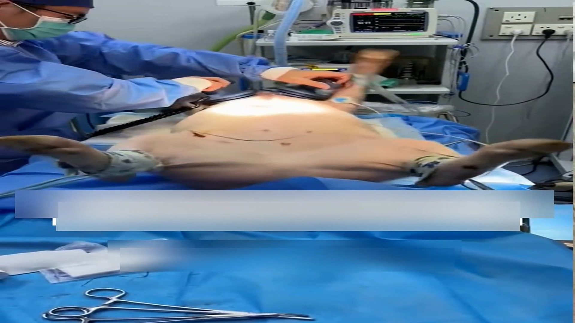 Part 2: Đ0707001_Rescue a pig that fell off a slaughterhouse truck and then #rescue #f..._blurred_part2